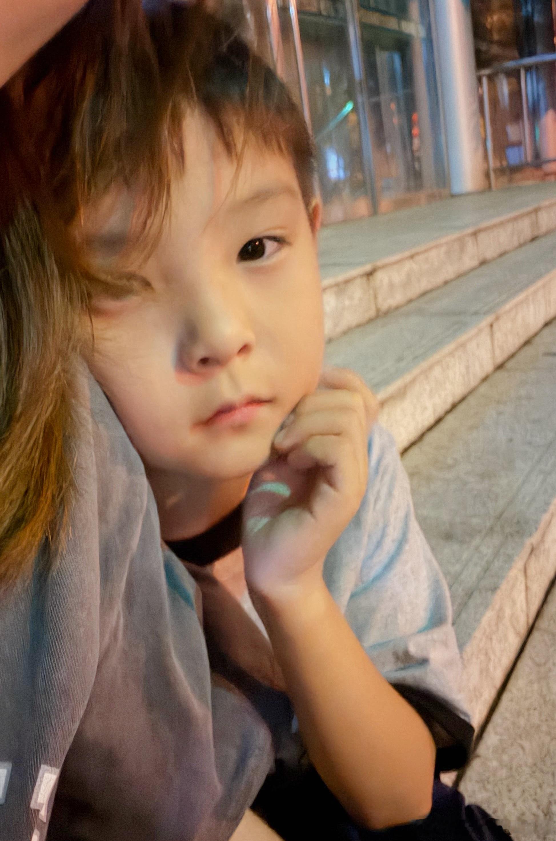 我都快睡着了安子说脸疼，怕是腮腺炎带他来看看