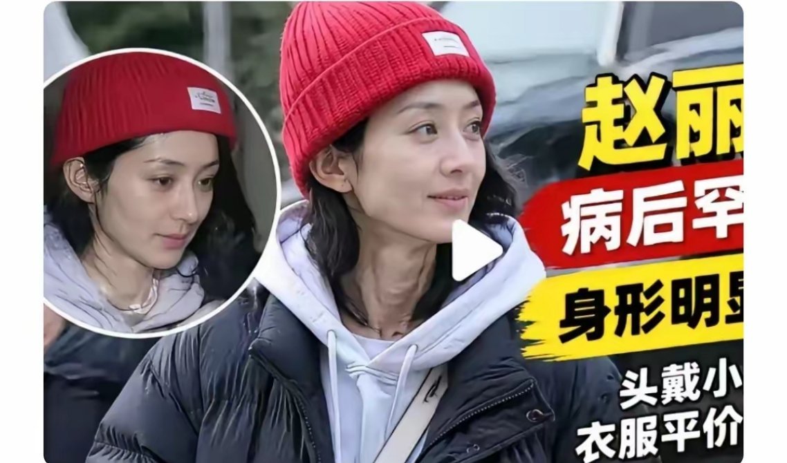 赵丽颖病后首度现身，她都瘦脱相了！身形明显小了一大圈，脸也瘦得出现了高颧骨，脸上