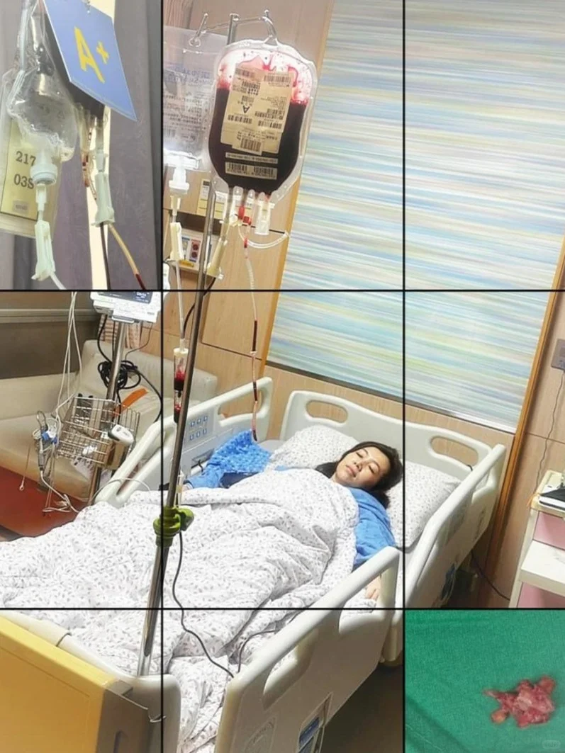 香港豪门阔太剧痛紧急开刀！术前输了两轮血
