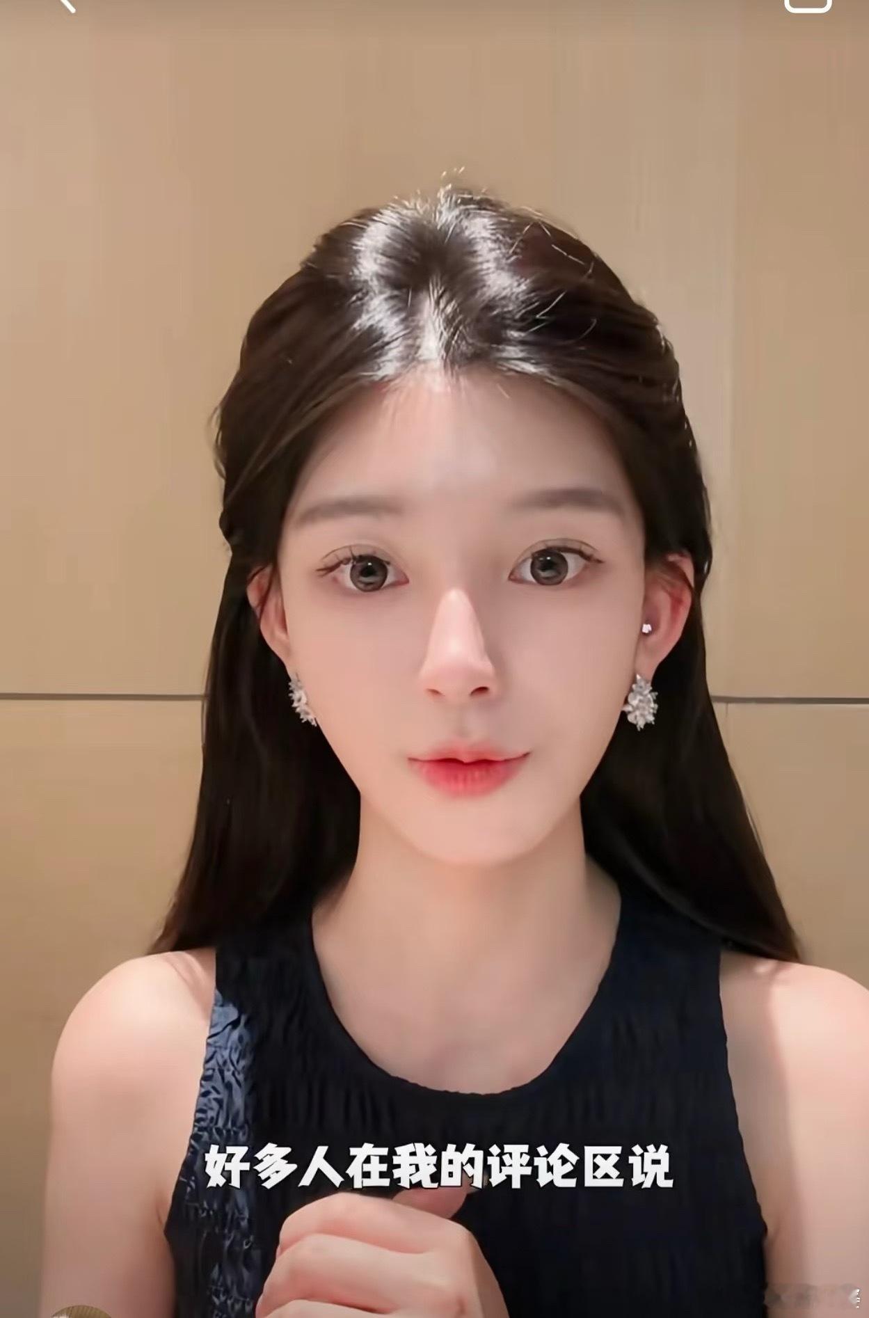 ally又去do脸了Ally又去do脸了，说脸小了一圈但修复期停播，还自曝“上瘾