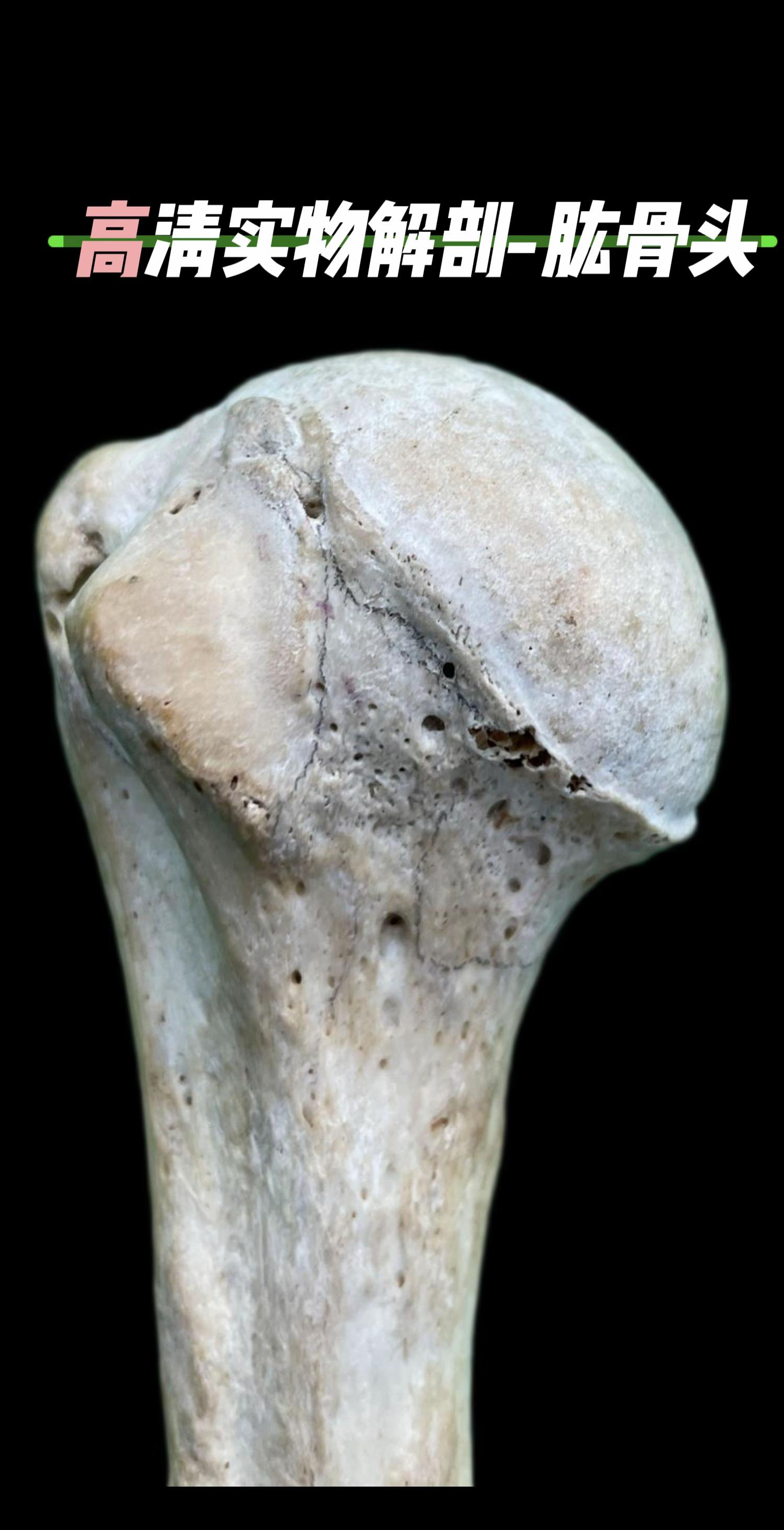 高清实物解剖，带您看清肱骨头的每一面。我们肩关节的核心——肱骨头。它...