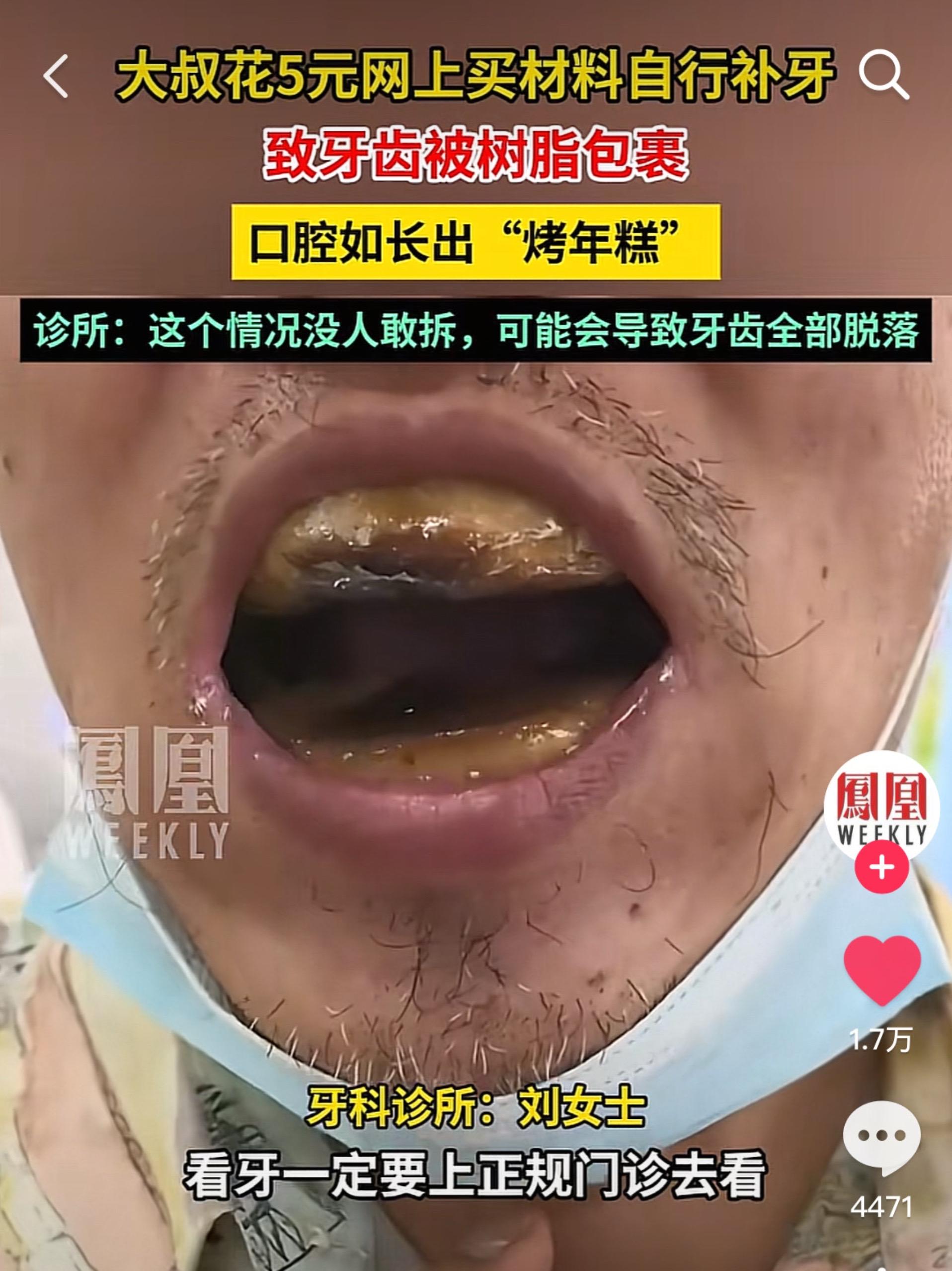 有人知道这个大叔怎么联系吗？我想尽微薄之力！！媒体只是像笑话一样报道了...