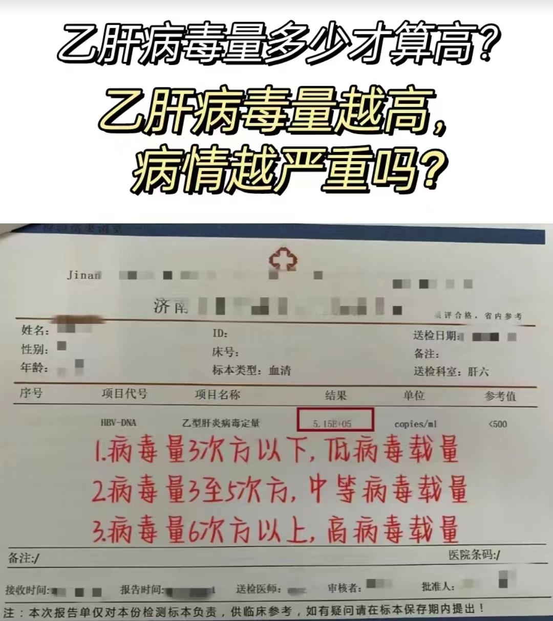 乙肝病毒量多少才算高？