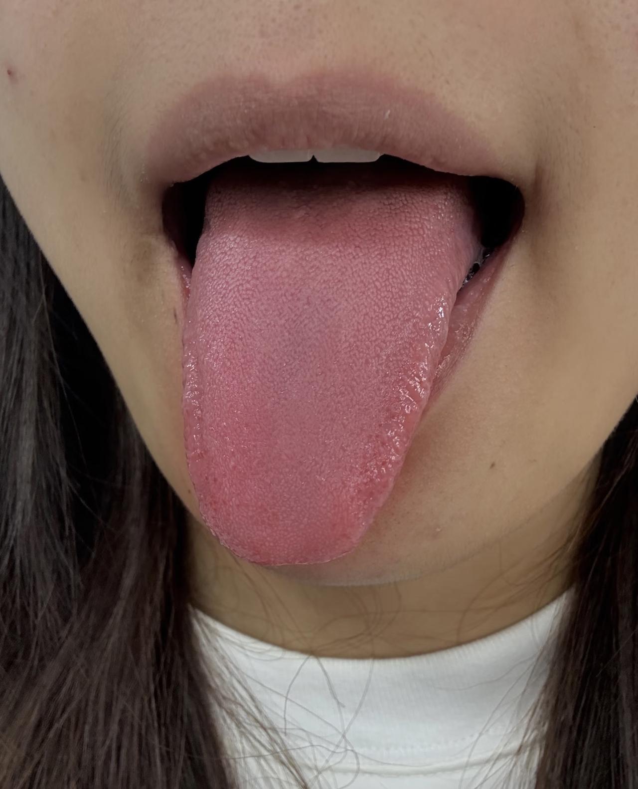 口臭不单是尴尬，更是身体“警报”！常见四种类型，对号入座才能根治！

口臭让人不