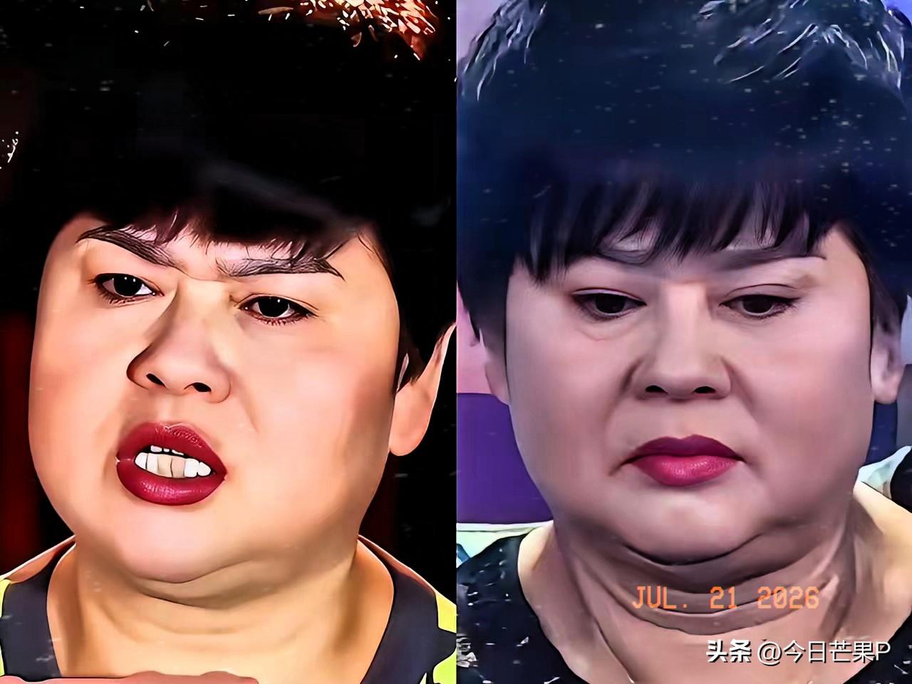 看到45岁邹市明丈母娘的长相[捂脸]
我瞬间明白了，嫁人不嫁单亲妈妈带大的儿子，