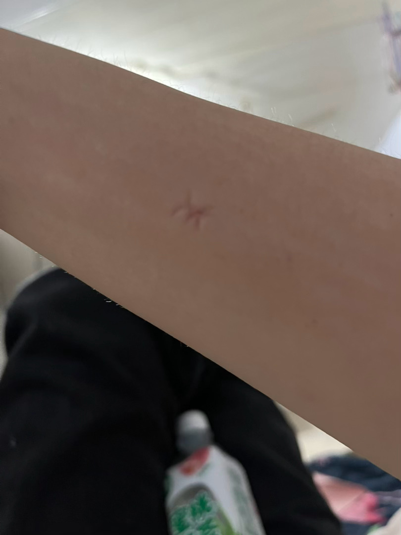 我从上海回江苏，就是为了来喂饱蚊子的脚、腿、手、胳膊无一幸免我太仁义了