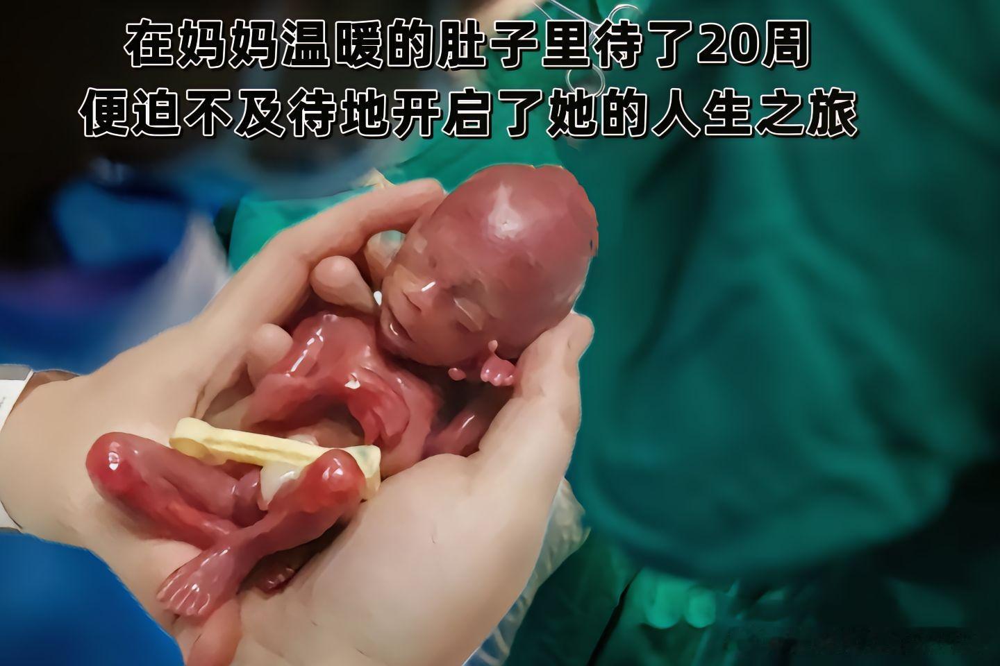 出生后的日子里，保温箱成了他的第一个“避风港”[鼓掌][鼓掌][鼓掌][鼓掌][