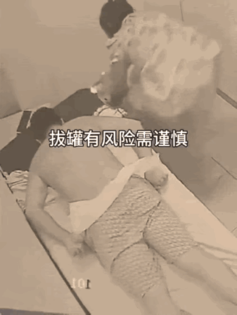 这是拔罐吗？这是拔命啊！真正的“拔罐惊魂”，这技师也太不专业了！