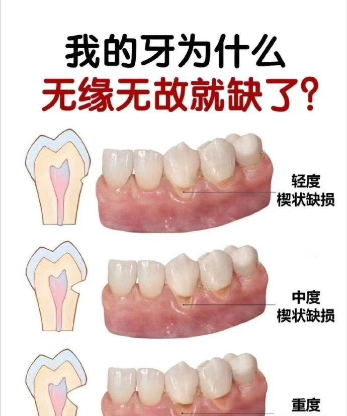 今天是分享牙科科普小知识的一天！咱们来聊聊日常口腔管理那些事儿，毕竟拥有一口好牙