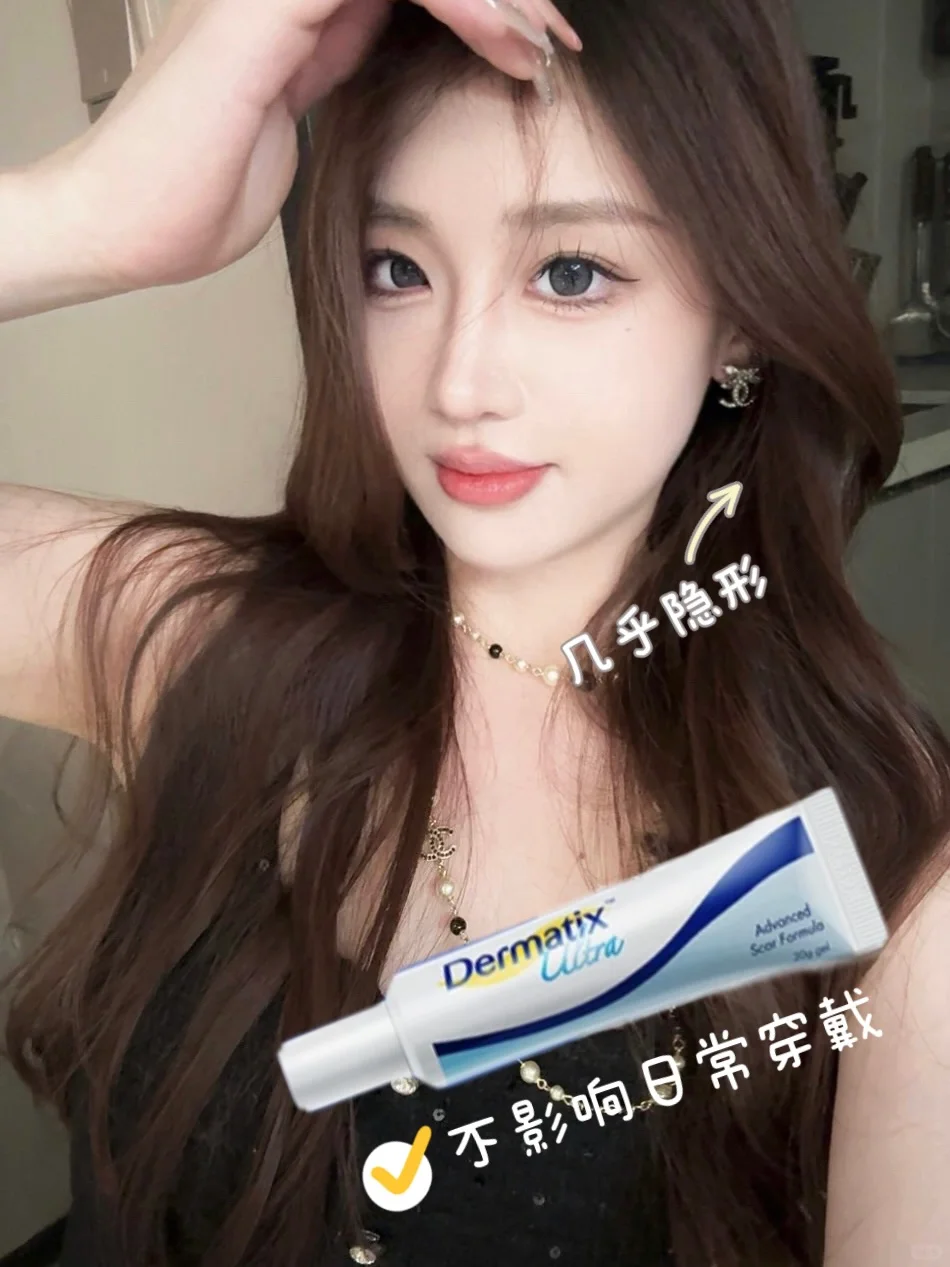 耳洞增生的姐妹们👀过来！疤痕体质不焦虑啦