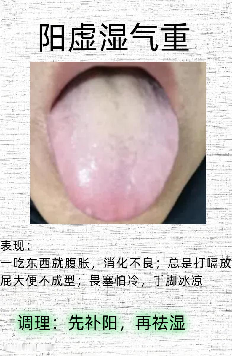 今日舌诊分享！

一、阳虚湿气重

二、脾肾阳虚寒湿重

三、肝气郁结，脾胃虚弱