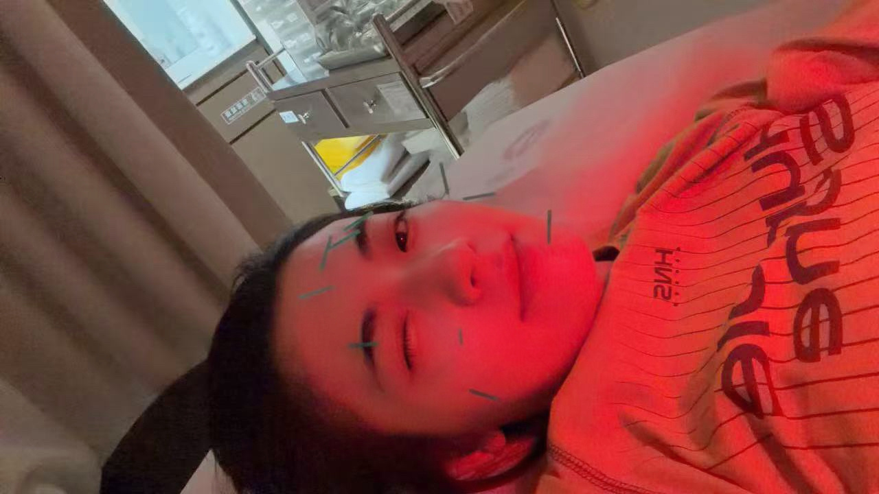今天有时间去见了我的中医我和他说每天痒的和猴子一样，不敢挠，挠了就是大疙瘩，接下