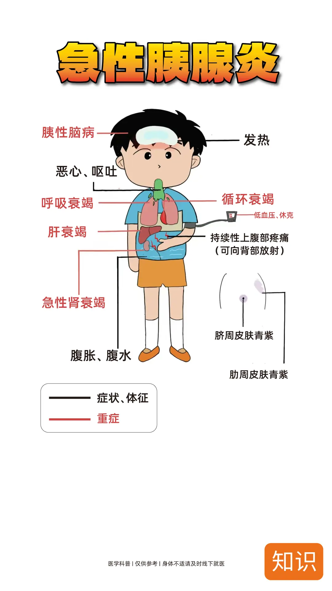 急性胰腺炎的症状，记下来！