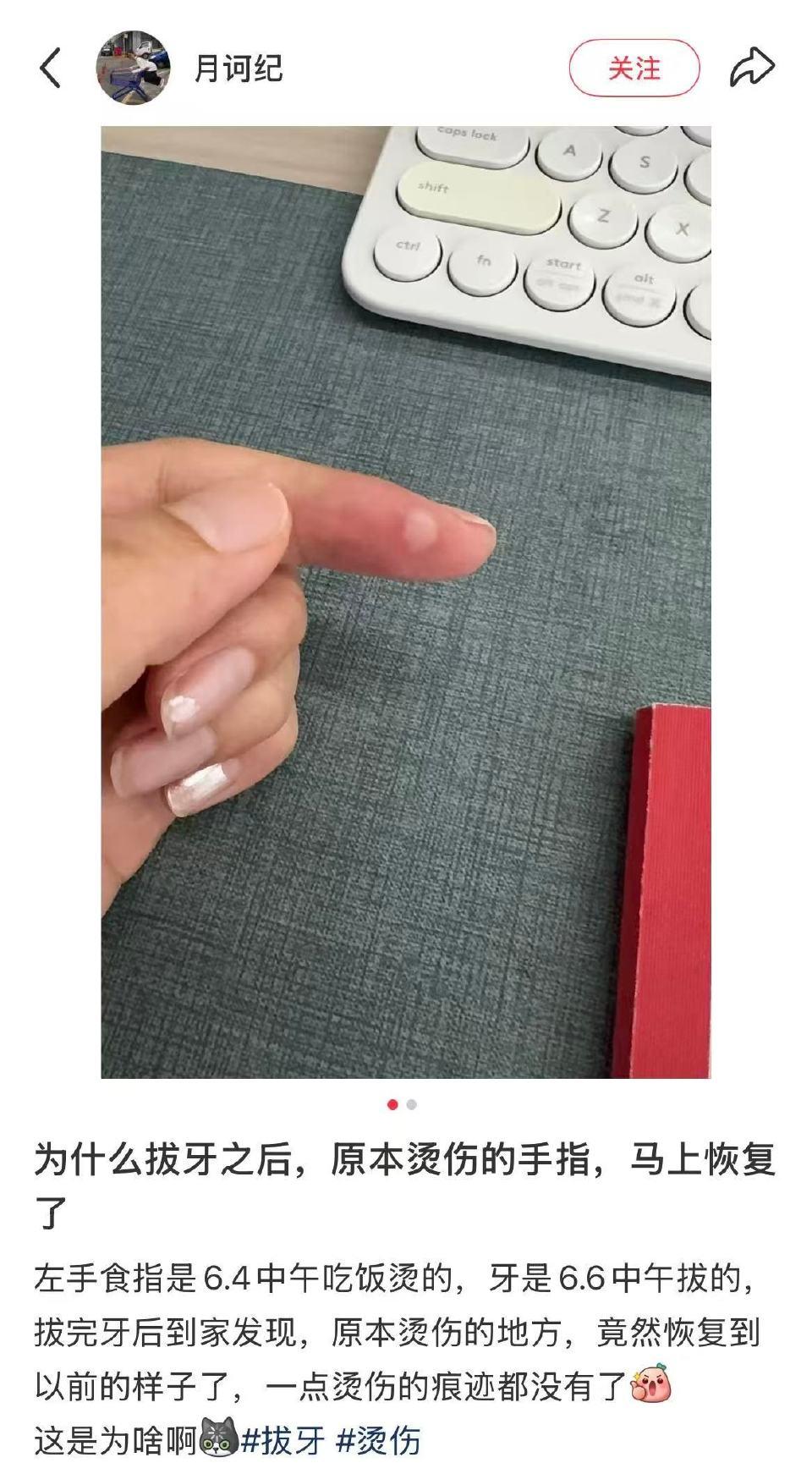 原来免疫系统也是分等级工作的 ​​​