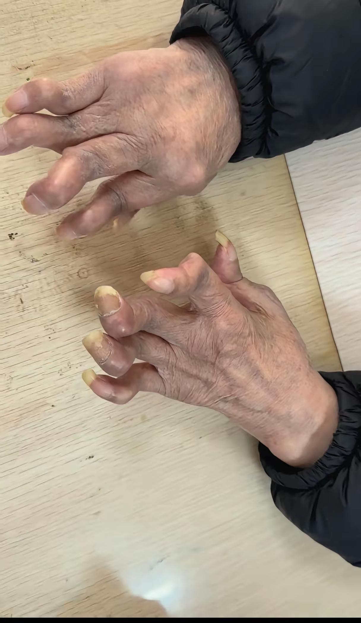 现在科技这么发达
为什么这个病治不好呢？