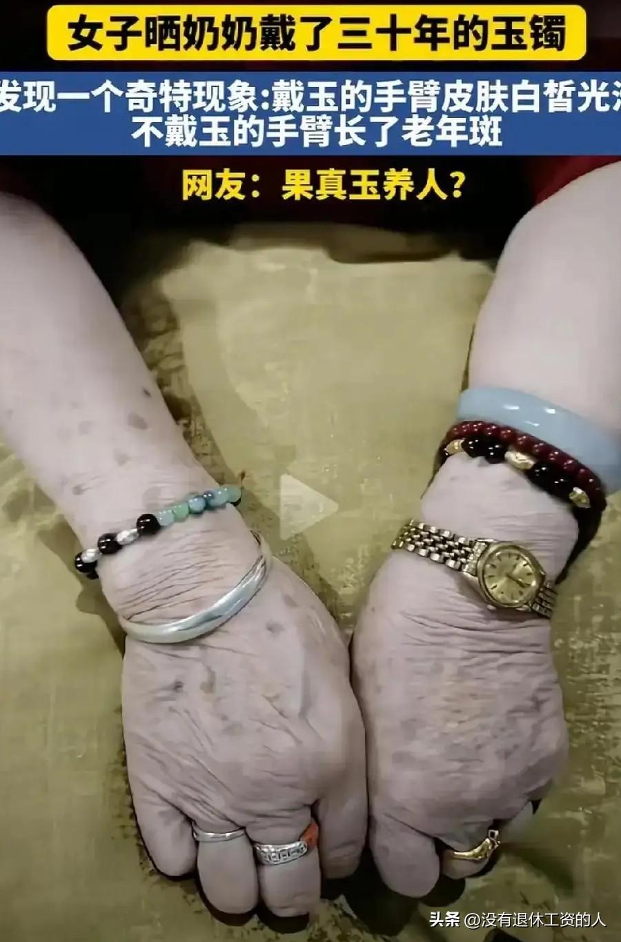 玉真的能够养人吗？

近日，有一女子在网上，分享了奶奶戴30年玉镯的手臂。发现戴