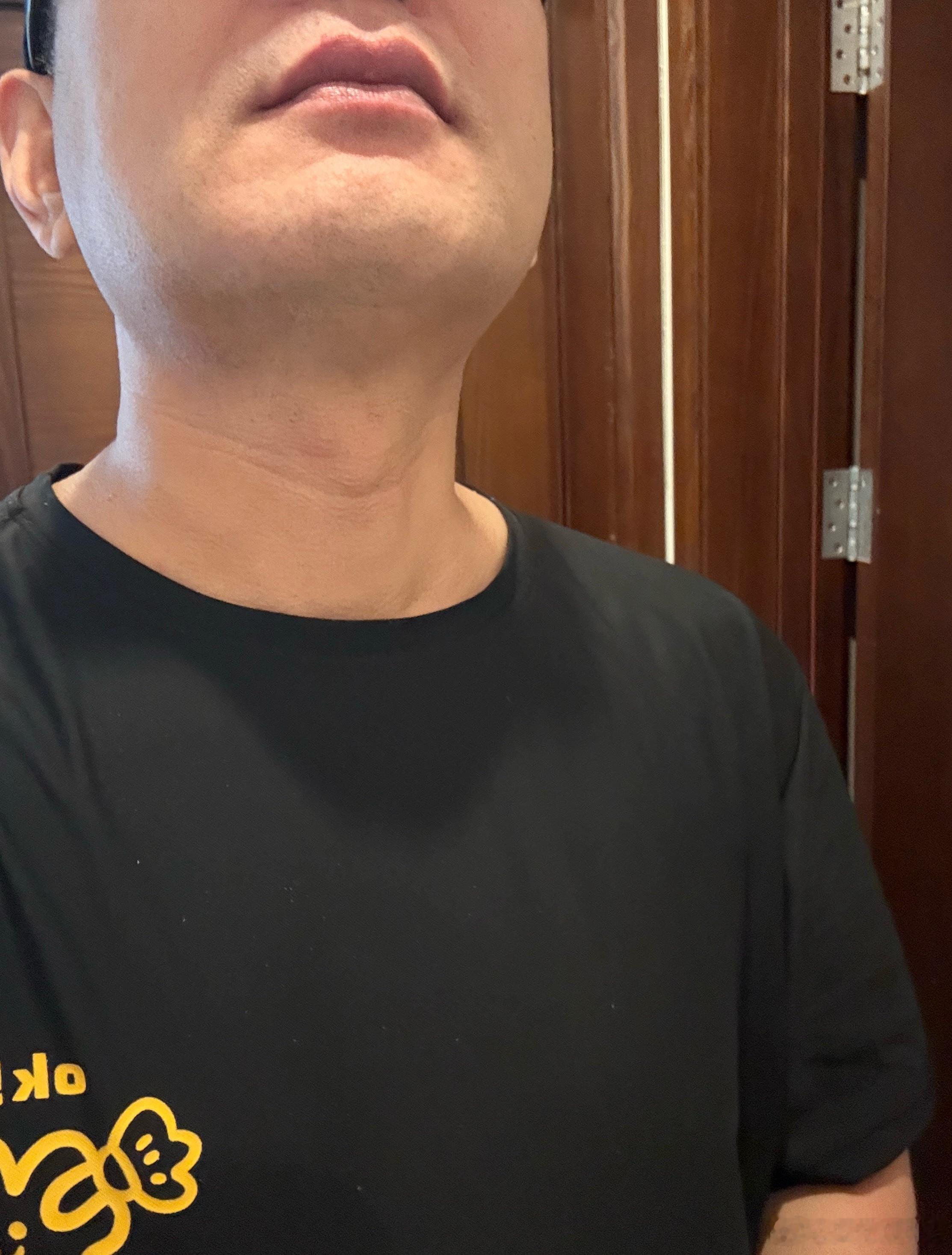 三天没刮胡子的我和刚挂完胡子的我 ​​​