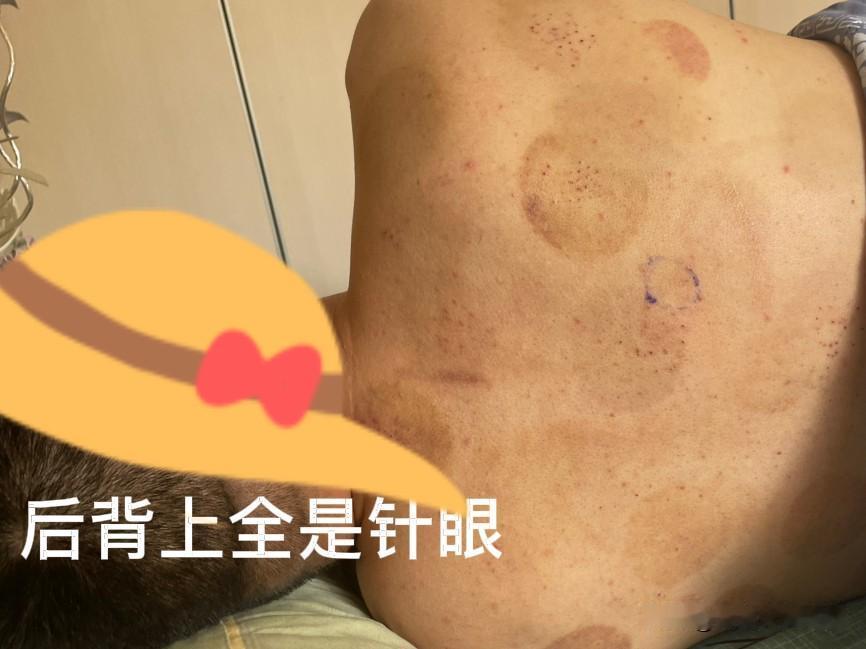 病急乱投医，今天针灸回来还是疼。

先给郑州的当医生的老表打电话问了一下有没有什