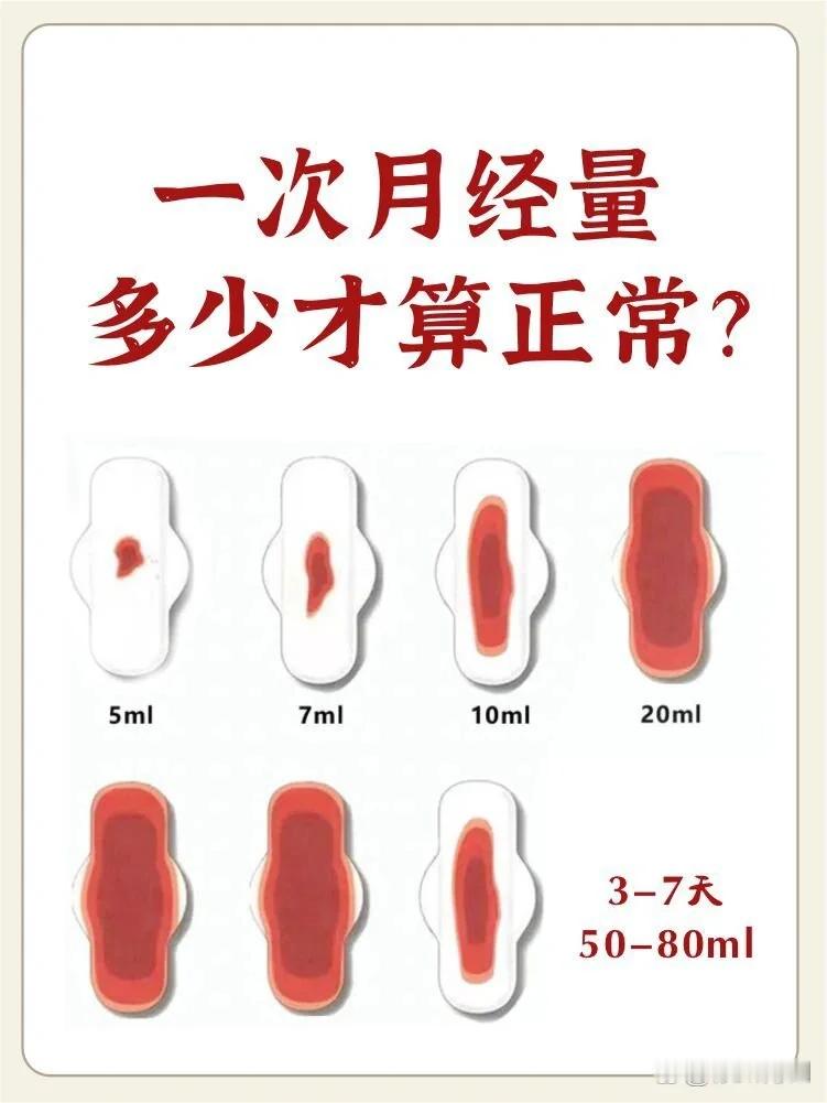 月经量大和量少哪个更健康 科普：月经量 20‑60ml 为正常，过多过少均可能提