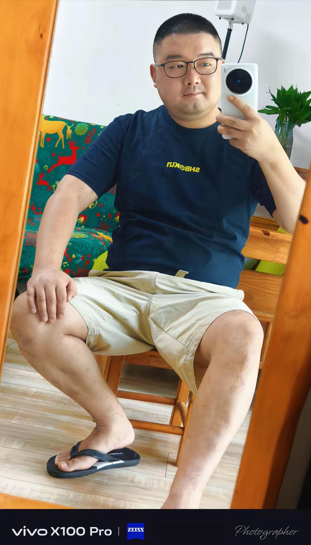 以前年轻的时候皮肤恢复能力还挺好，现在年纪大了一身的伤疤好了都是黑印，代谢也越来