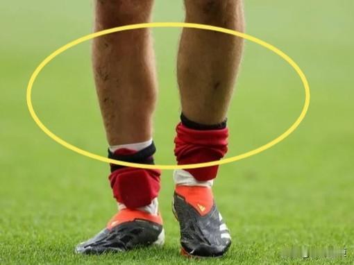 为什么负责任的青训教练，会坚决制止青少年球员使用短款护腿板？！[what]

大