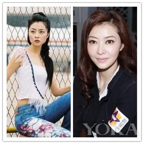 熊黛林没整容的时候脸型长得太四方了，她整容后很成功，非常的漂亮自然。
方媛是天生