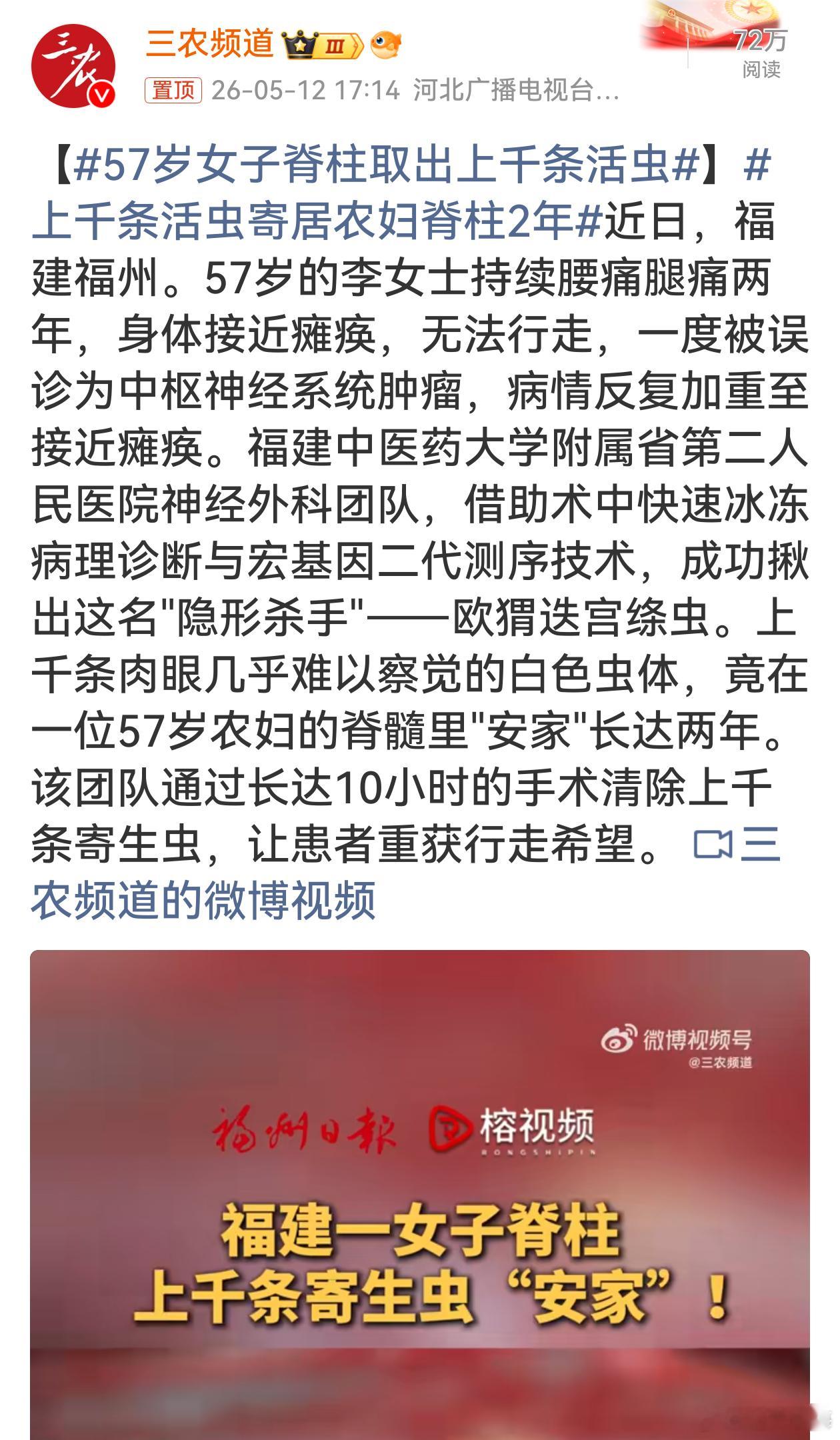 57岁女子脊柱取出上千条活虫 57 岁李女士脊柱寄居上千条活虫，病情严重几近瘫痪