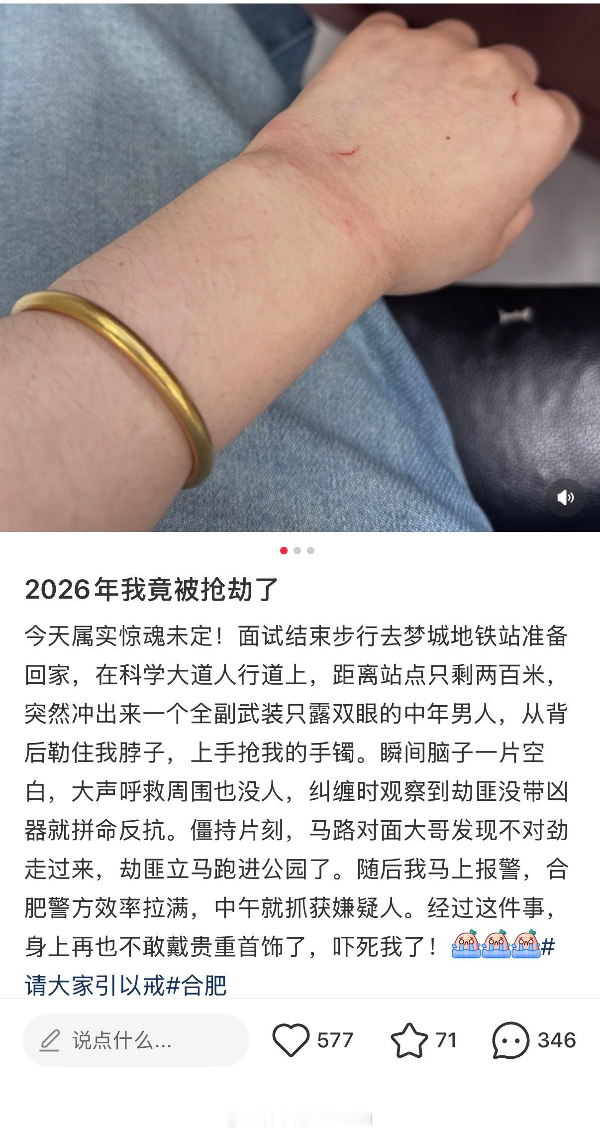 太吓人了火速摘掉手镯带的久了不好摘套上塑料袋，抹上洗洁精瞬间摘下来了，神奇不戴首