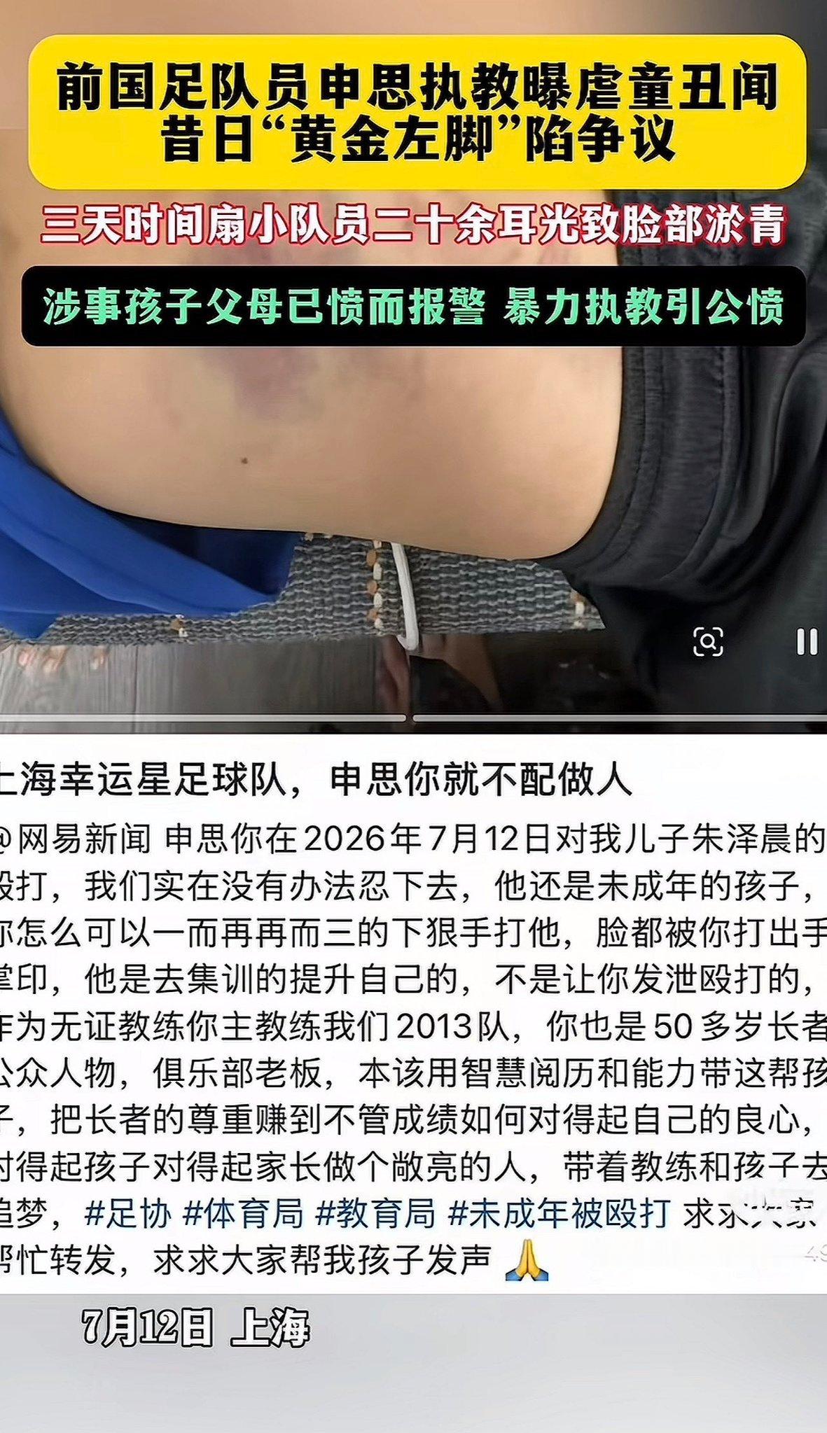 这帮人素质非常差，社会化程度很低。 