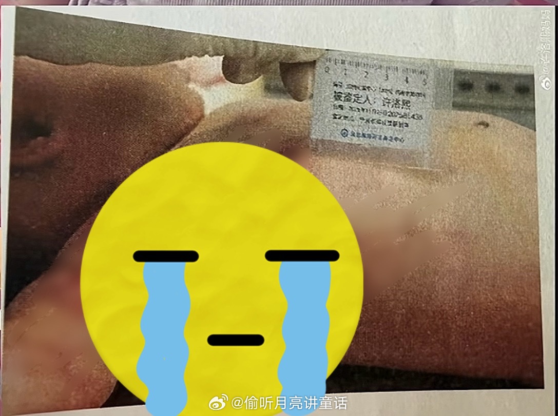 小洛熙父母至今还在努力维权  明明可以选择拿一笔不菲的赔偿金……小洛熙