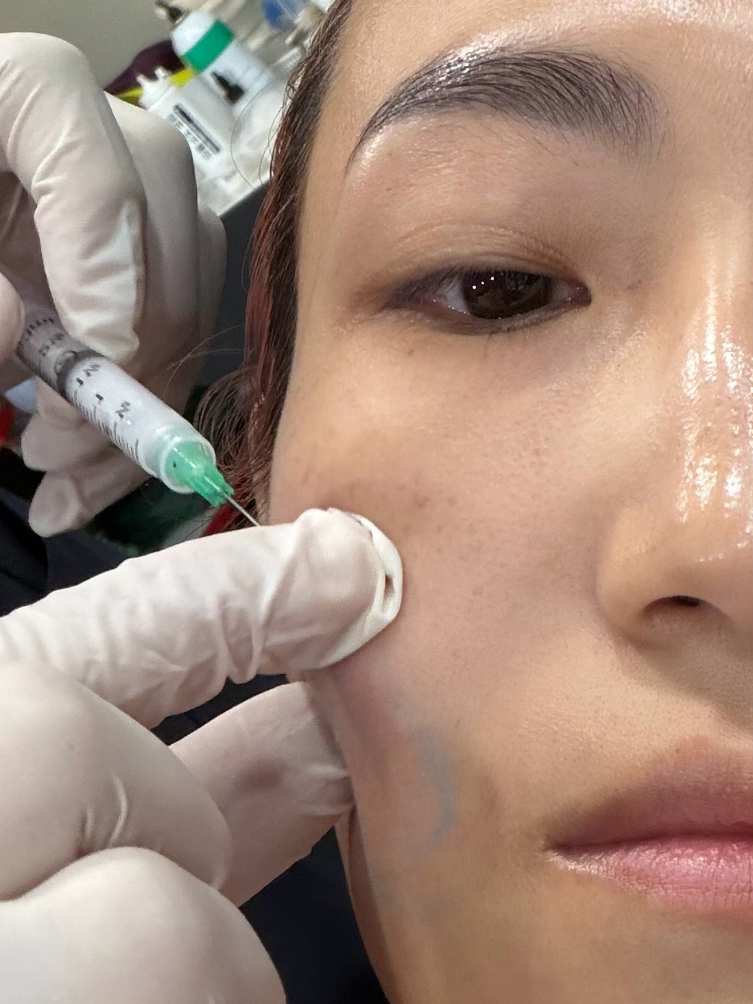 昨天给我打针的是个韩国大叔。三角眼，蓬松头，声线很低很粗，身材健硕的那种四十岁中
