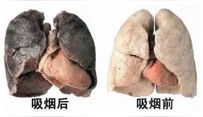 扎心真相！权威研究证实：吸烟者平均寿命短10年
 
很多老烟民总抱着侥幸心理，觉