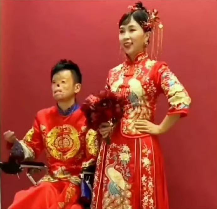 90后消防员在大火中救出女孩，他不幸重度烧伤，女孩不顾家人反对毅然嫁给了小伙。女