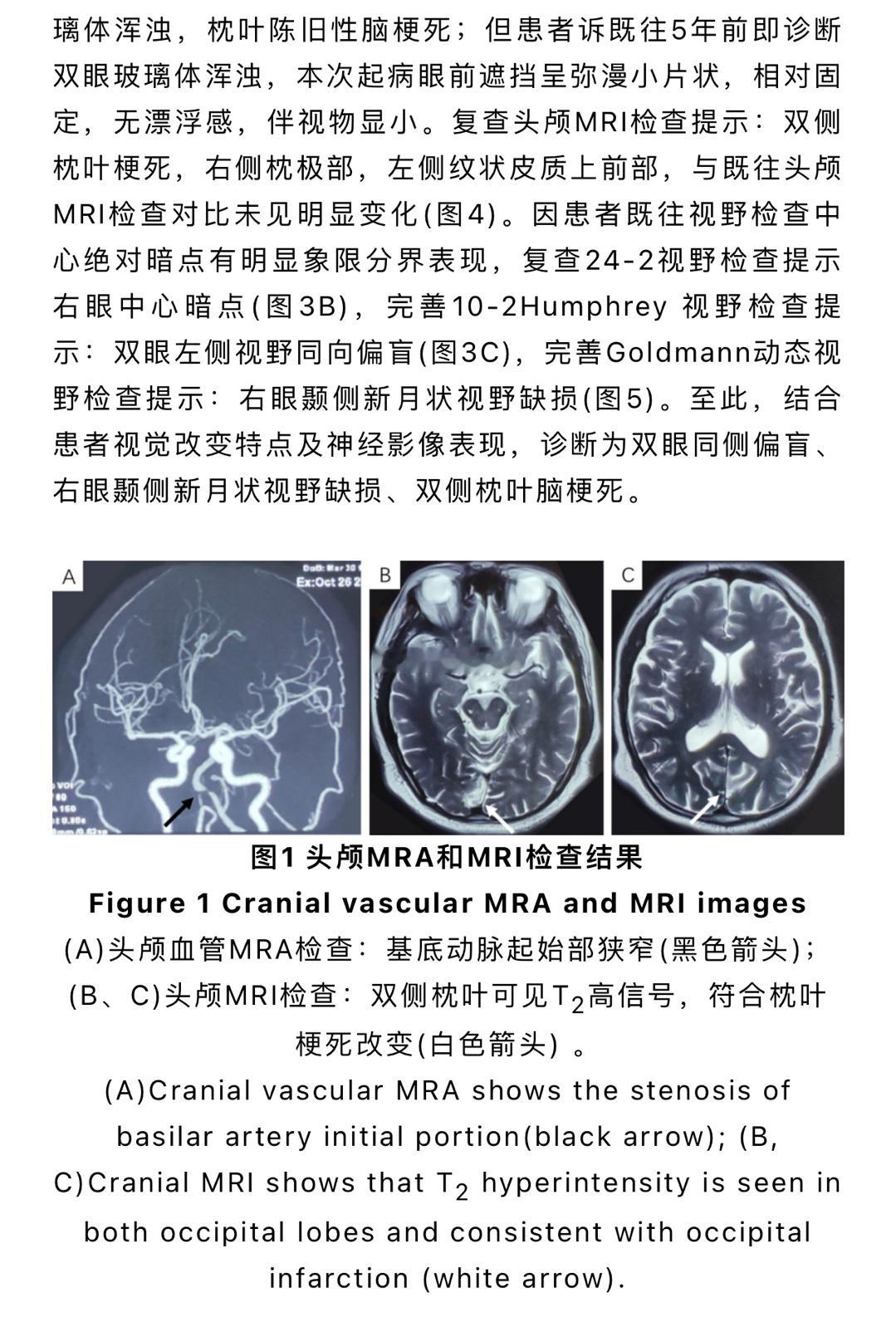 周一最是繁忙，上午除了病房的事情，还看了不少门诊病人，今天主打高端局，一个比一个