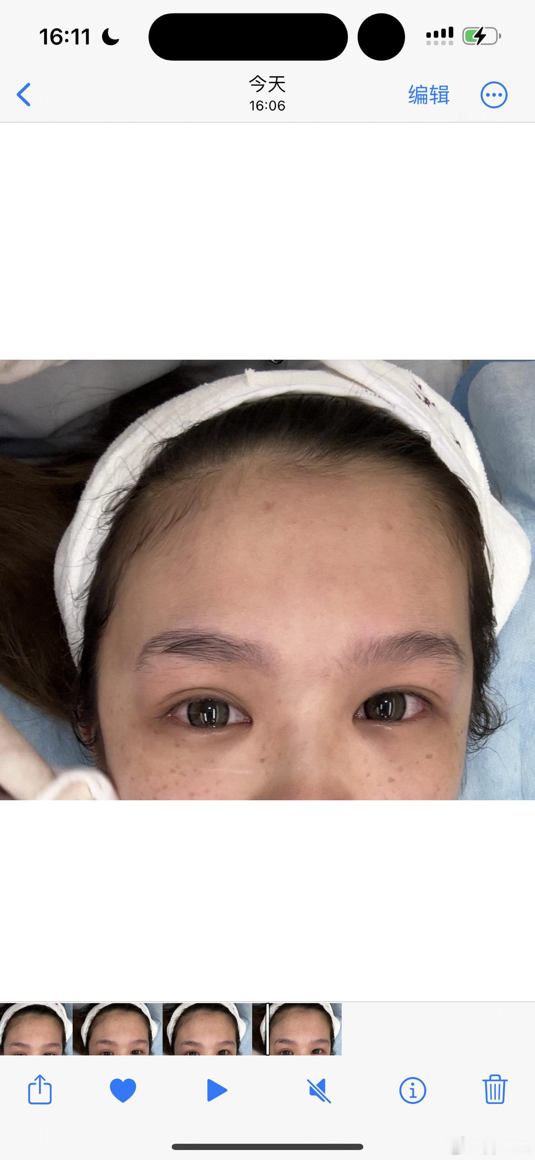 做超声炮疼的哇一声哭出来了 你们懂吗 就是刚出生婴儿那种哇一下嘴一瘪后的大哭 太