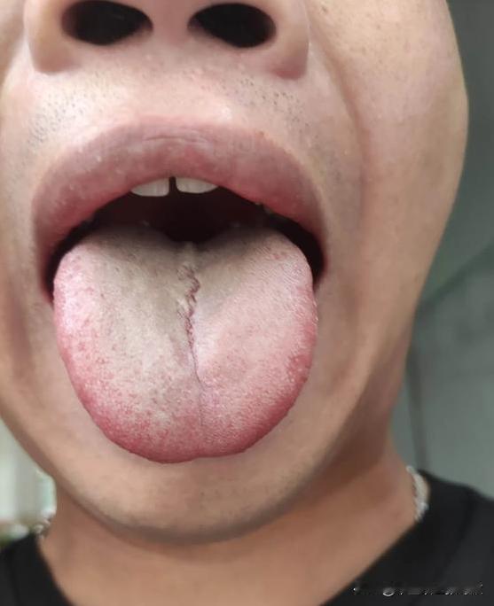 结婚还不到一年，这家伙造的，直接肾精亏虚[捂脸][捂脸][捂脸]

平时：腰酸腰
