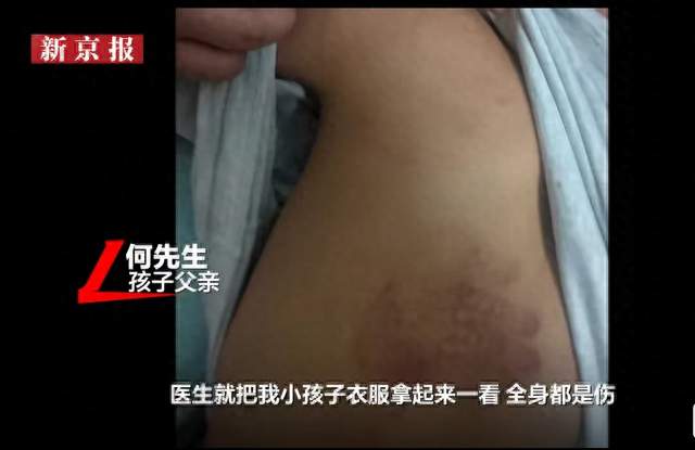 9岁男童因调皮被老师殴打住院，这到底是“管教”还是犯罪？
