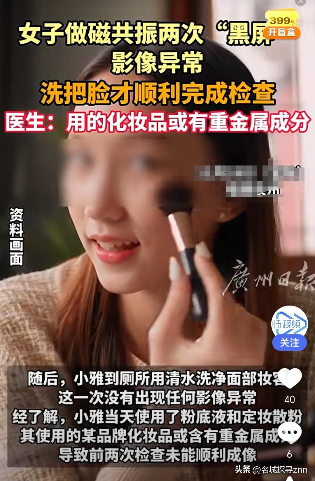 解释不清了！福建一29岁女生头晕，去医院做头颅磁共振。不料，连续2次扫描，都因面