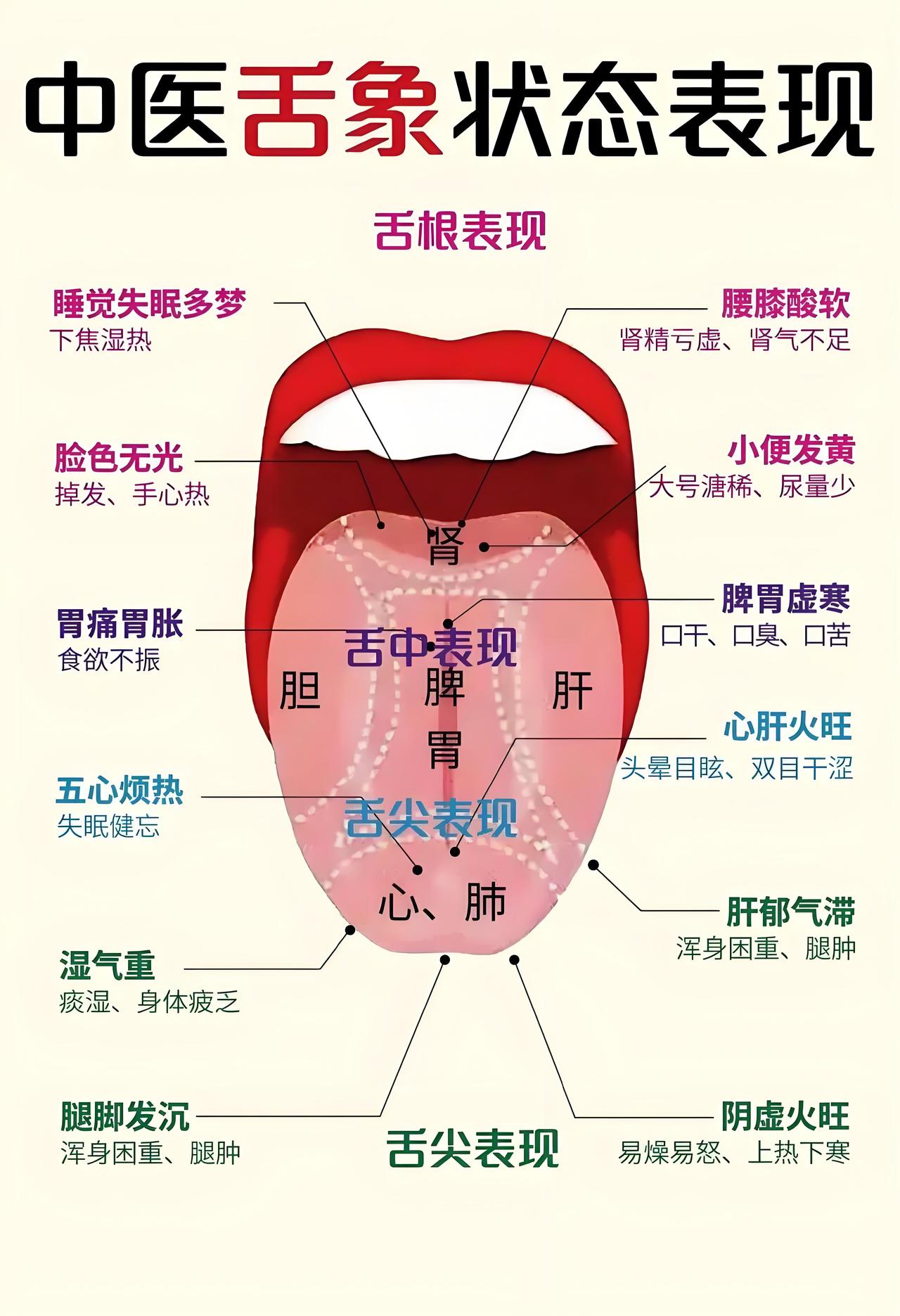 类风湿好转后，她学会了每天看舌苔！

有个深圳的类风湿患者，患病3年了，刚开始两