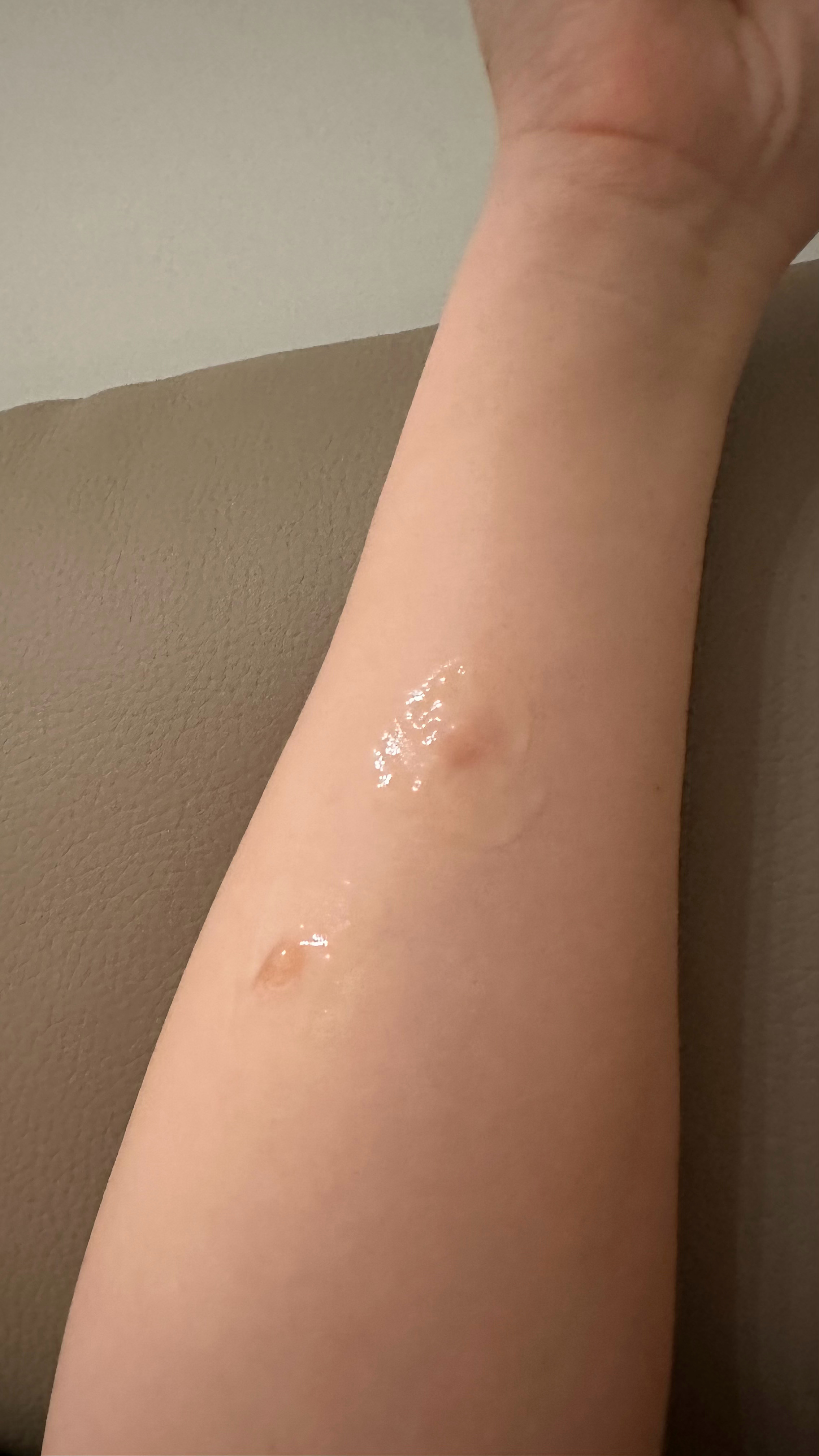 中午无意中和妞爸说，呃！中午做饭溅到的热油又加了两点。其实做饭的人，都习以为常了