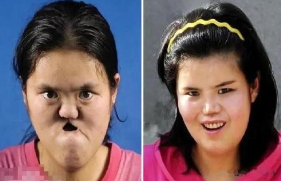 1988年，陕西一老农捡到一个没有嘴巴和鼻子的女婴，为了将其抚养长大，将自己的亲