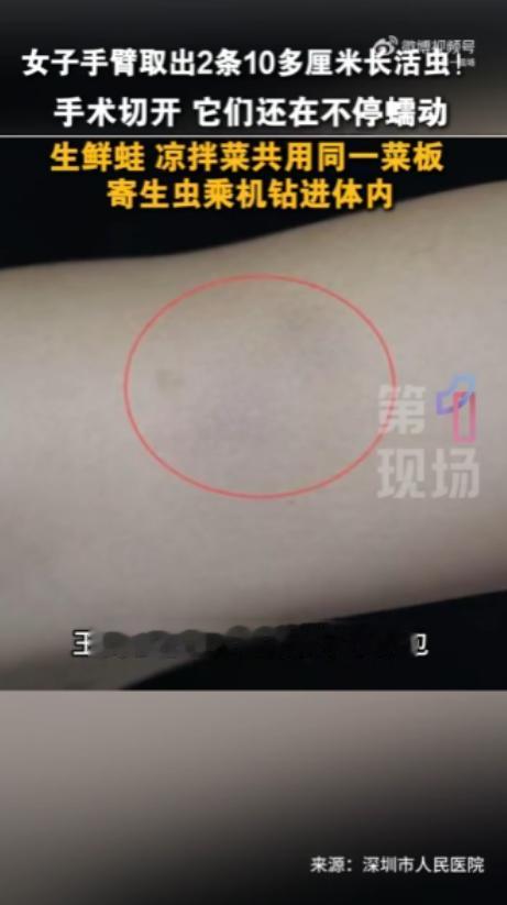 “太吓人了！”广东深圳，王女士手臂上长了个包块，她忍了整整一年，起初以为是囊肿，
