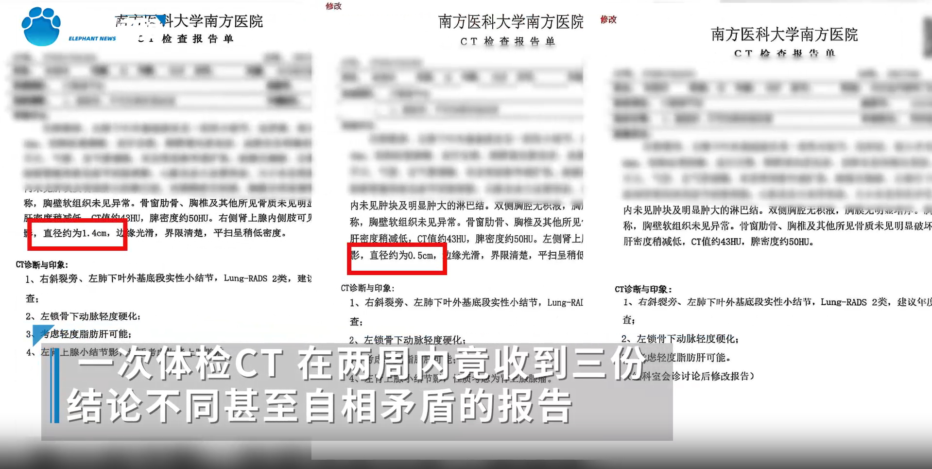 #从肿瘤到没事医院公信力何在#【快评丨同一部位三份CT报告，“从肿瘤到没事”医院