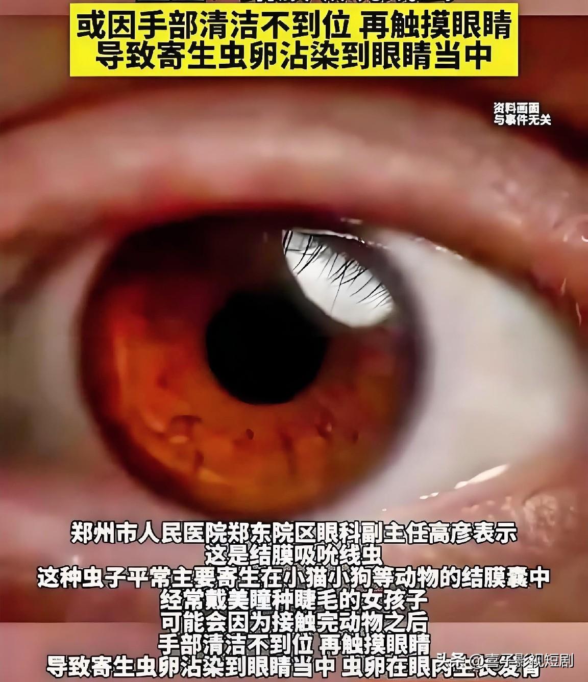 谁见过这么硬核的女生！虫子飞进眼里，她连水都没找，直接徒手就给扒拉出来了。
前几