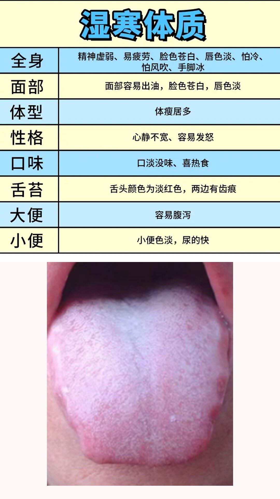 如果你浑身疲惫、头脑昏沉没有精神[困][困]
只要去咨询中医，绝对会一本正经的告