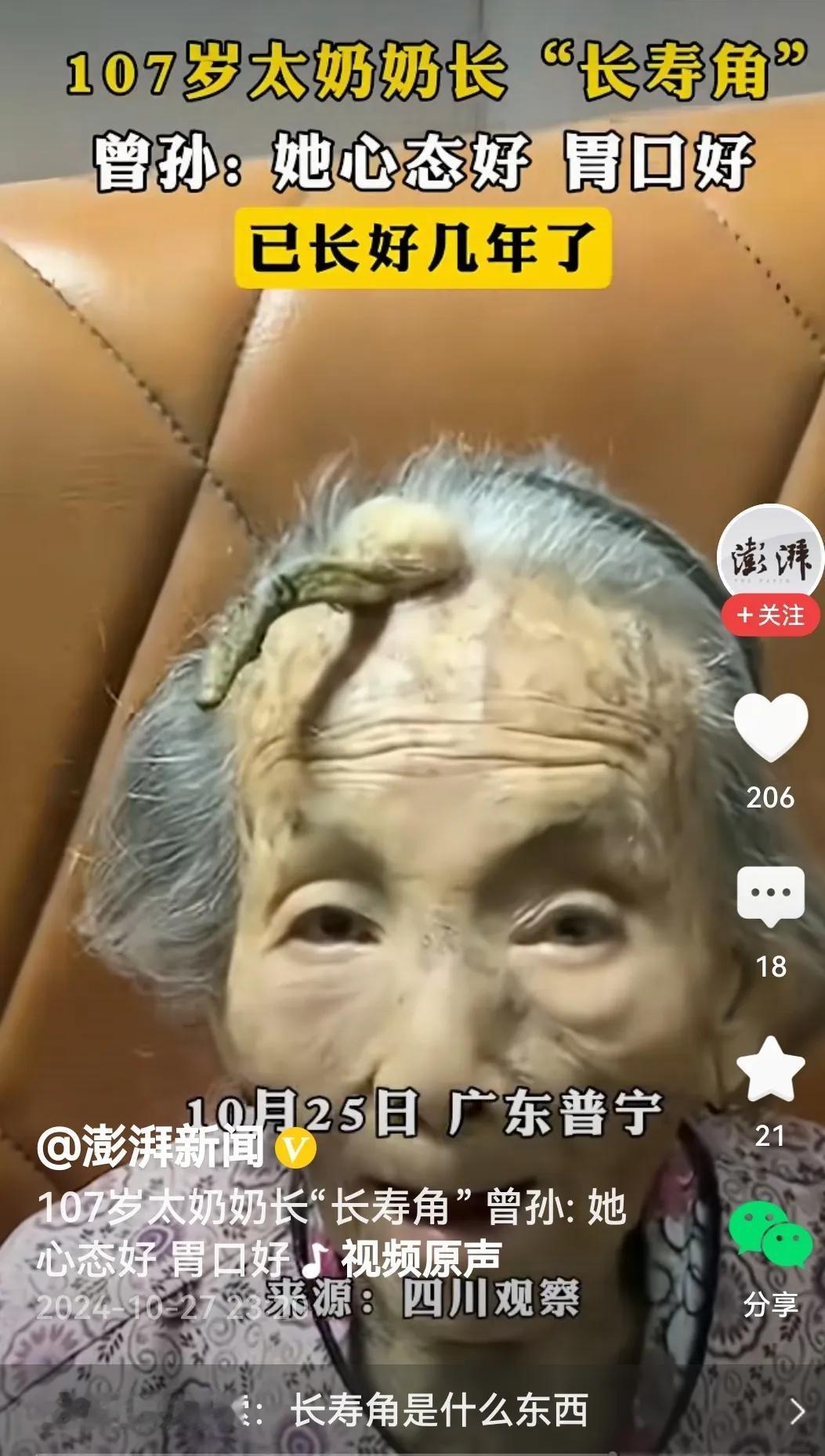 #107岁老奶奶额头长出“长寿角”#
还真是，这位老奶奶不但寿比南山，107岁了