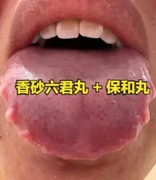 健脾王中王：“香砂六君丸”加上这1宝，强脾胃，化净从头到脚的痰，更能补满全身气血
