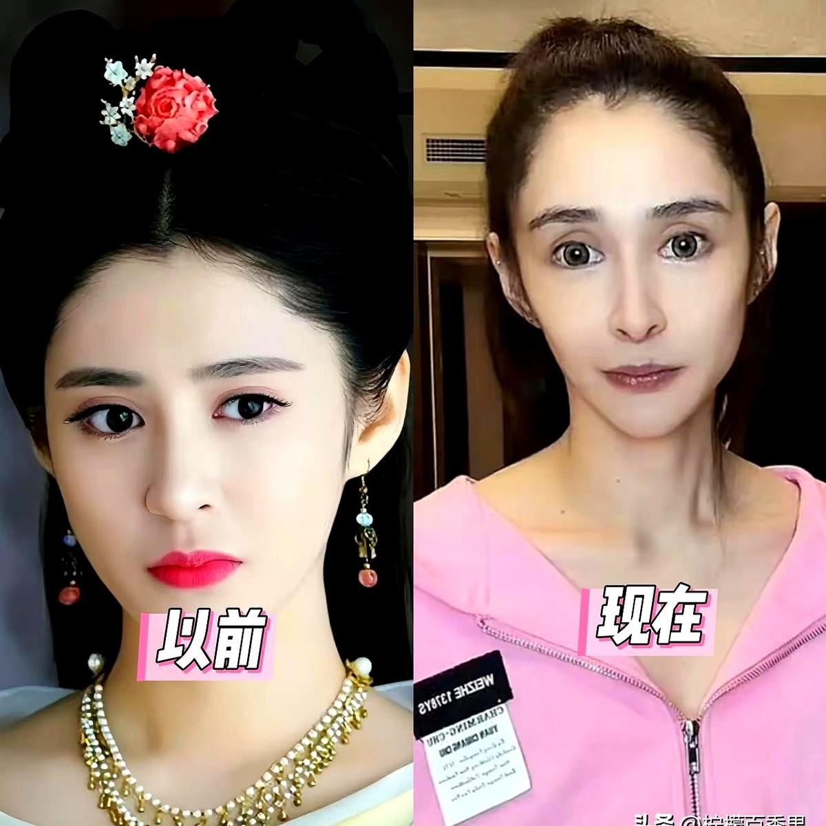 四个月硬生生剐掉80斤肉，当年古装剧里的第一美人，现在瘦脱相了。

李心艾产后体