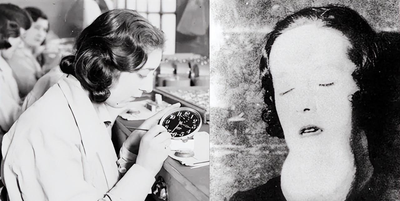 上个世纪二十年代，在美国的玛吉亚去看牙医，医生轻轻捏着女孩的下巴，准备拿器具敲打