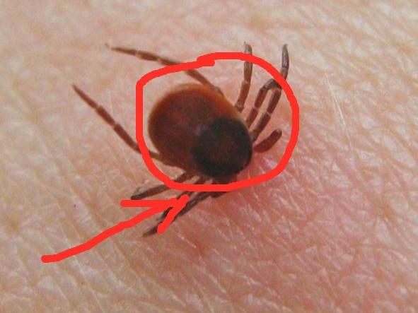 70岁以上老人最怕蜱虫，在农村到处都有蜱虫。这种虫子很小不仔细看发现不了，经常在